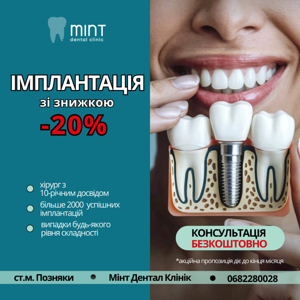 імплант 20%